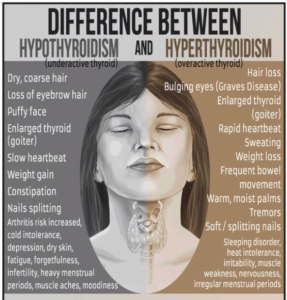 Difference between Hypothyroidism and Hyperthyroidism